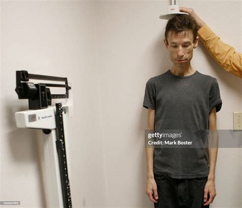 anerexic|anorexic patients.